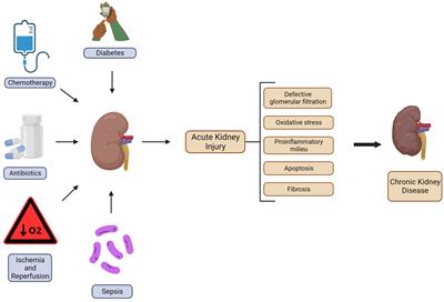Physical exercise as a friend not a foe in acute kidney diseases through immune system modulation